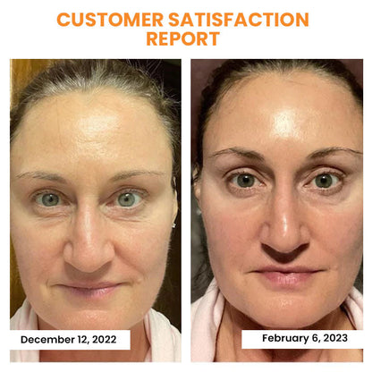 🔥Seurico™ Korea Soluble Anti-Wrinkle Collagen Mask