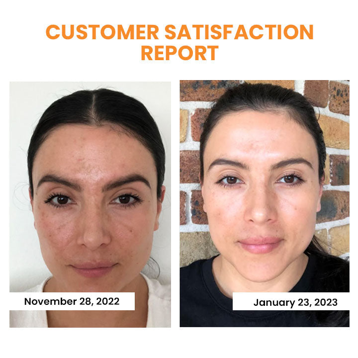 🔥Seurico™ Korea Soluble Anti-Wrinkle Collagen Mask