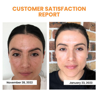 🔥Seurico™ Korea Soluble Anti-Wrinkle Collagen Mask
