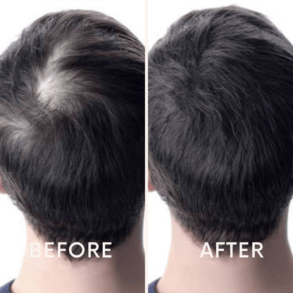 🔥Seurico™ Patented🔥 Red Light Therapy Hair Growth Cap