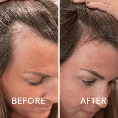 🔥Seurico™ Patented🔥 Red Light Therapy Hair Growth Cap