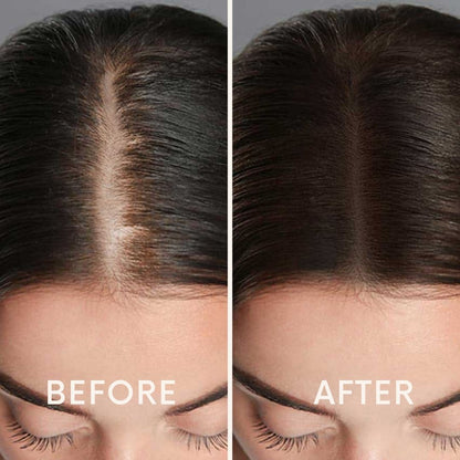 🔥Seurico™ Patented🔥 Red Light Therapy Hair Growth Cap