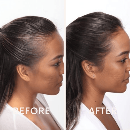 🔥Seurico™ Patented🔥 Red Light Therapy Hair Growth Cap