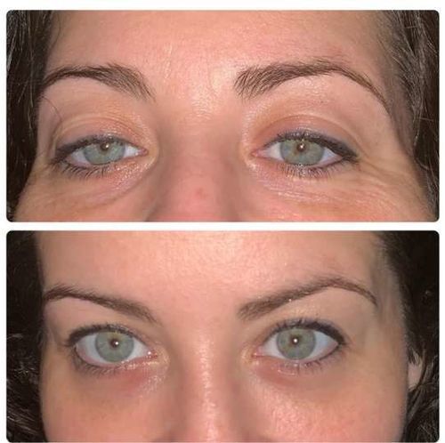 OSUFI™ Korea Eye Firming Serum