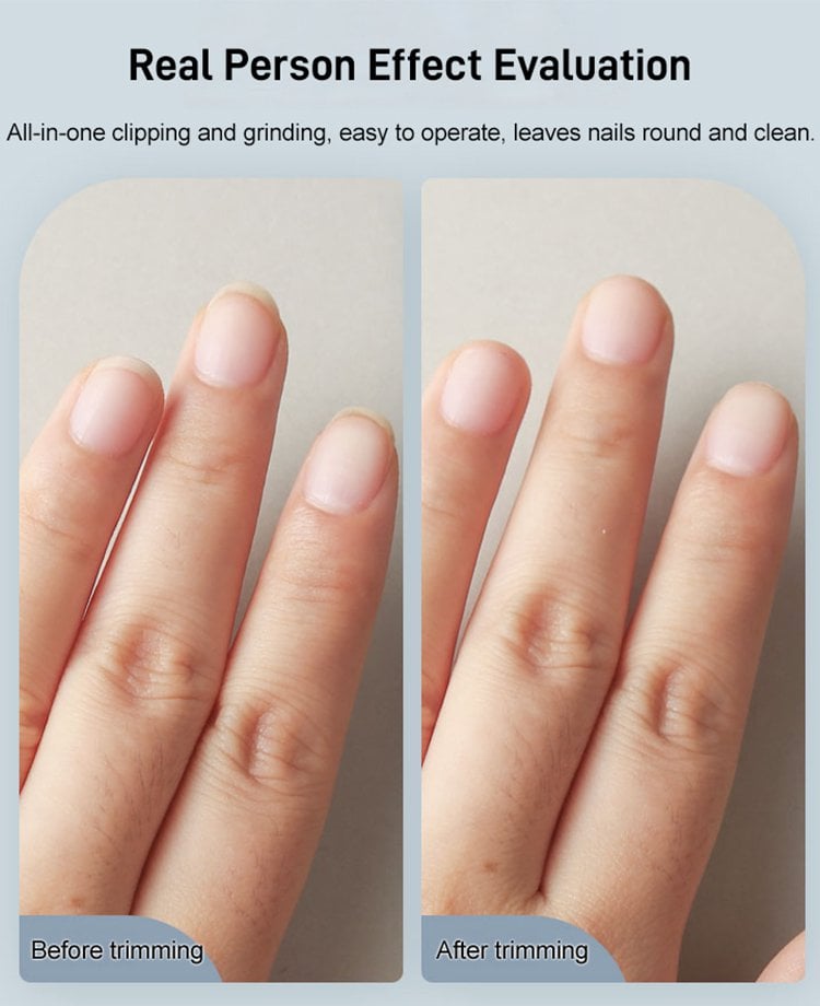 Seurico™ Made in Germany🎉 Electric Automatic Nail Clipper