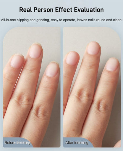 Seurico™ Made in Germany🎉 Electric Automatic Nail Clipper