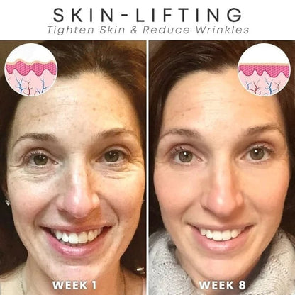 Last Day Promotion 49% OFF - 🔥Seurico™ Face Serum
