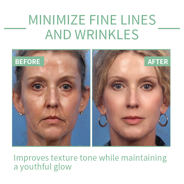 🔥Limited-time 70% discount🔥 [PH]Iller Peptide Anti-Aging Face Serum