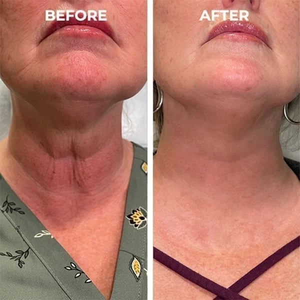 Last Day Promotion 49% OFF - 🔥Seurico™ Face Serum