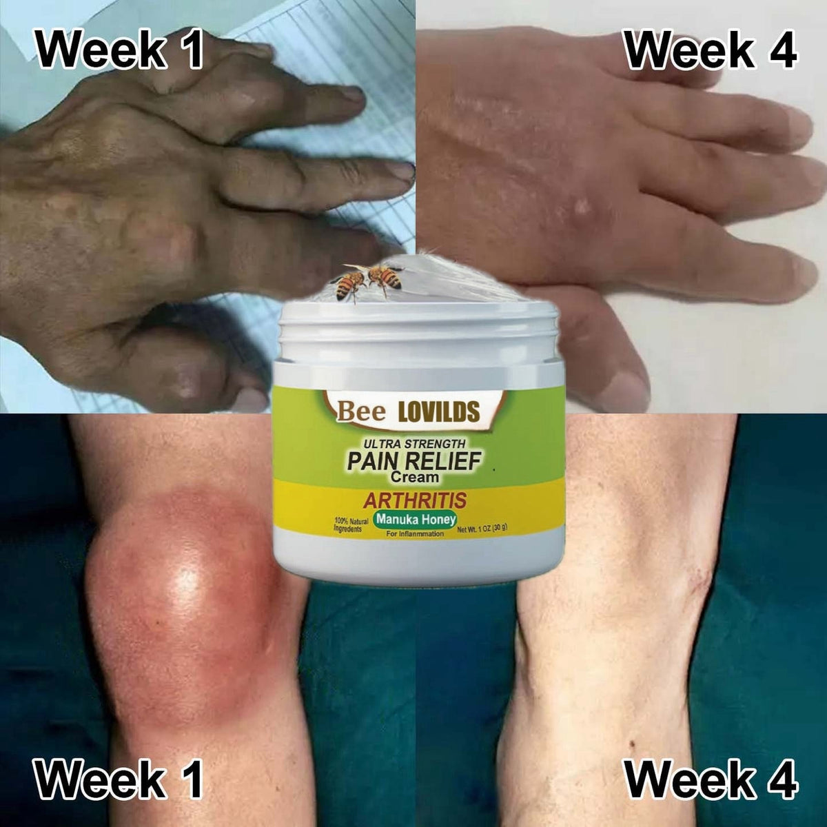 🔥 The first 1,000 people on sale get 80% off! 🔥Seurico™ New Zealand Bee Venom Joint and Bone Therapy Advanced Cream🐝
